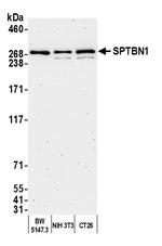 SPTBN1 Antibody in Western Blot (WB)