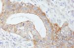 SPTBN1 Antibody in Immunohistochemistry (Paraffin) (IHC (P))