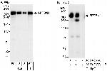 SPTBN1 Antibody in Western Blot (WB)