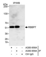 RbBP7 Antibody in Immunoprecipitation (IP)