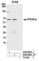 PPP2R1A Antibody in Immunoprecipitation (IP)