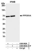 PPP2R1A Antibody in Immunoprecipitation (IP)