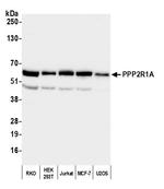 PPP2R1A Antibody in Western Blot (WB)