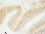 CTNND1 Antibody in Immunohistochemistry (Paraffin) (IHC (P))