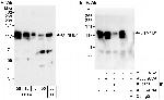 CTNND1 Antibody in Western Blot (WB)