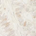 APC Antibody in Immunohistochemistry (Paraffin) (IHC (P))