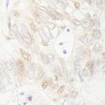 APC Antibody in Immunohistochemistry (Paraffin) (IHC (P))