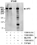 APC Antibody in Immunoprecipitation (IP)