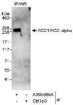 ACC1/ACC-alpha Antibody in Immunoprecipitation (IP)