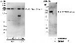 ACC1/ACC-alpha Antibody in Western Blot (WB)