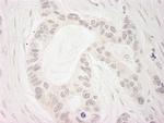 BubR1 Antibody in Immunohistochemistry (Paraffin) (IHC (P))