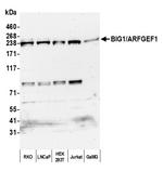 BIG1/ARFGEF1 Antibody in Western Blot (WB)