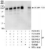 ADAMTS13 Antibody in Western Blot (WB)