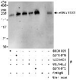 ADAMTS13 Antibody in Western Blot (WB)