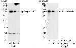 Periplakin/PPL Antibody in Western Blot (WB)