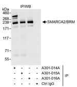 SMARCA2/BRM Antibody in Immunoprecipitation (IP)