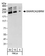 SMARCA2/BRM Antibody in Western Blot (WB)