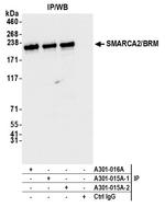 SMARCA2/BRM Antibody in Immunoprecipitation (IP)