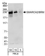 SMARCA2/BRM Antibody in Western Blot (WB)