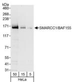 SMARCC1/BAF155 Antibody in Western Blot (WB)