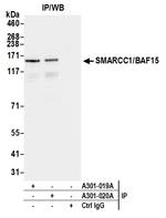 SMARCC1/BAF155 Antibody in Immunoprecipitation (IP)