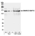 SMARCC1/BAF155 Antibody in Western Blot (WB)