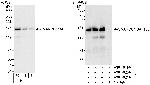 SMARCC1/BAF155 Antibody in Western Blot (WB)