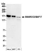 SMARCC2/BAF170 Antibody in Western Blot (WB)