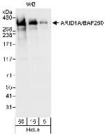 ARID1A/BAF250 Antibody in Western Blot (WB)