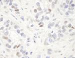 MAGED2 Antibody in Immunohistochemistry (Paraffin) (IHC (P))