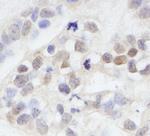 MAGED2 Antibody in Immunohistochemistry (Paraffin) (IHC (P))