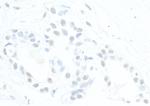 ATRX Antibody in Immunohistochemistry (Paraffin) (IHC (P))