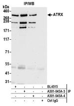 ATRX Antibody in Immunoprecipitation (IP)