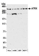 ATRX Antibody in Western Blot (WB)