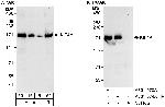 KIF4A Antibody in Western Blot (WB)