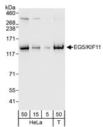 EG5/KIF11 Antibody in Western Blot (WB)