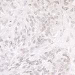 SMARCA1/SNF2L Antibody in Immunohistochemistry (Paraffin) (IHC (P))