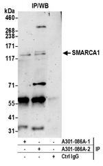 SMARCA1/SNF2L Antibody in Immunoprecipitation (IP)