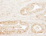 CPSF73 Antibody in Immunohistochemistry (Paraffin) (IHC (P))