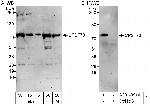 CPSF73 Antibody in Western Blot (WB)