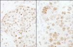 CPSF73 Antibody in Immunohistochemistry (Paraffin) (IHC (P))