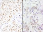 CSTF77 Antibody in Immunohistochemistry (Paraffin) (IHC (P))