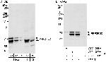 PPP2R5D Antibody in Western Blot (WB)