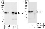 XRN2 Antibody in Western Blot (WB)