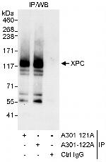 XPC Antibody in Immunoprecipitation (IP)