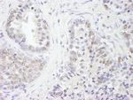 UBE1 Antibody in Immunohistochemistry (Paraffin) (IHC (P))