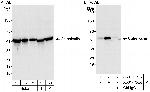 Calreticulin Antibody in Western Blot (WB)