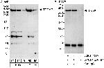 TRRAP Antibody in Western Blot (WB)