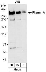 Filamin A Antibody in Western Blot (WB)