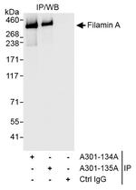 Filamin A Antibody in Immunoprecipitation (IP)